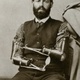 Illustration for article titled The History of Prosthetics Reveals a Long Tradition of Human Cyborgs